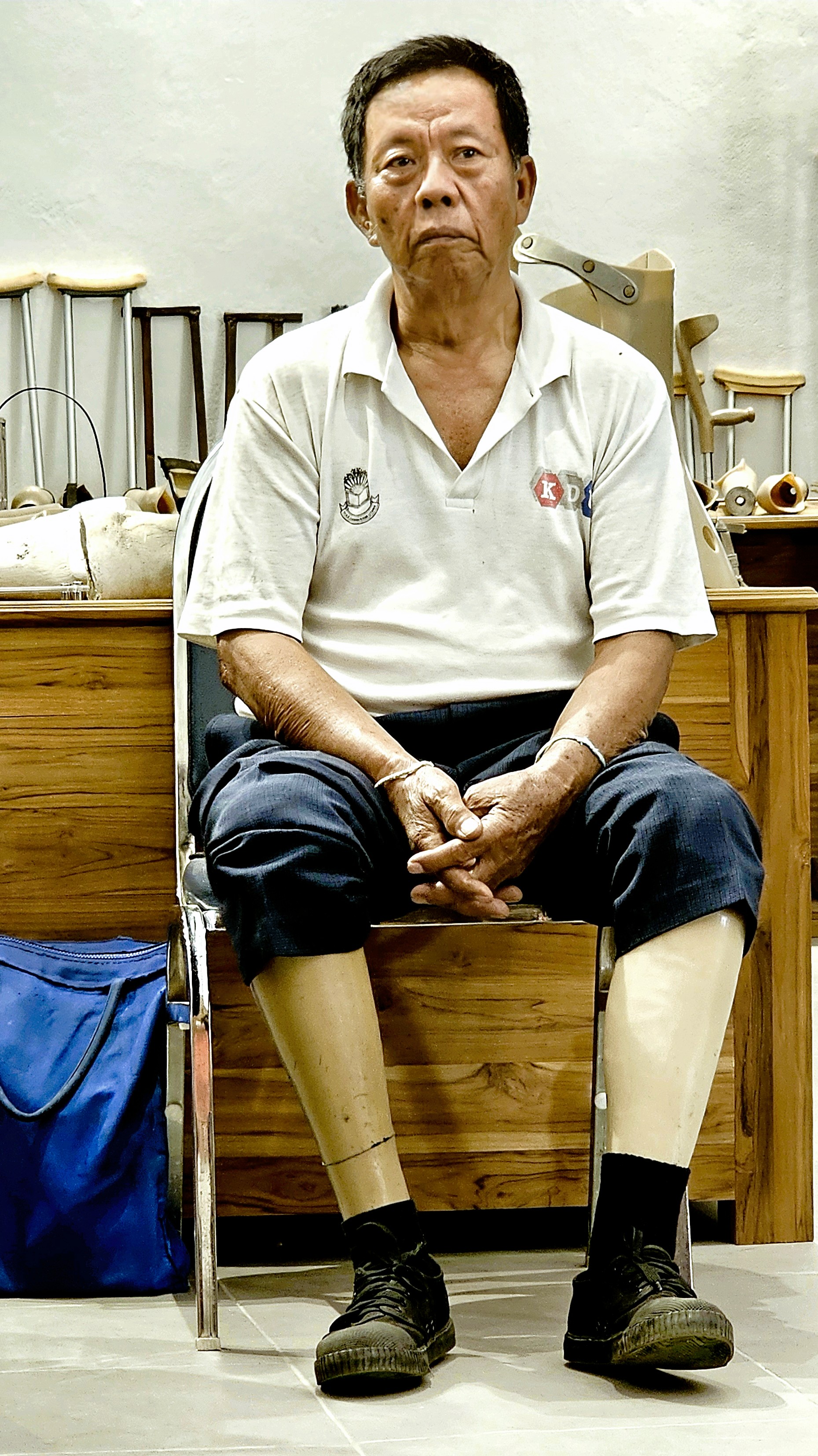 A middle-aged man sitting on a chair with a serious expression, wearing a short-sleeve shirt and dark pants, with both legs visibly amputated below the knee and wearing black shoes, in a room with wooden furniture and crutches in the background.
